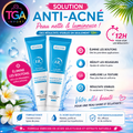 Crème anti acné